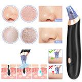 Removedor de la Espinilla, Blackhead Remover Vacuum Suction Removal tool Recargable y Ajustable Acné Extractor Juego de Herramientas de la Piel Facial Limpiador de Poros Máquina Comedón Exfoliante para la Mujer FDA Certificada