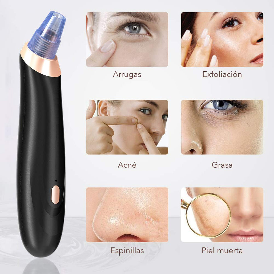 Removedor de la Espinilla, Blackhead Remover Vacuum Suction Removal tool Recargable y Ajustable Acné Extractor Juego de Herramientas de la Piel Facial Limpiador de Poros Máquina Comedón Exfoliante para la Mujer FDA Certificada