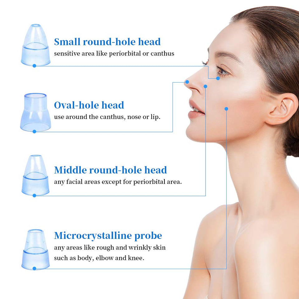 Removedor de la Espinilla, Blackhead Remover Vacuum Suction Removal tool Recargable y Ajustable Acné Extractor Juego de Herramientas de la Piel Facial Limpiador de Poros Máquina Comedón Exfoliante para la Mujer FDA Certificada